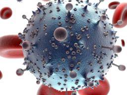 HIV: Strahlenexposition vor Stammzelltransplantation "kann Berliner Patienten möglicherweise nicht geheilt haben"