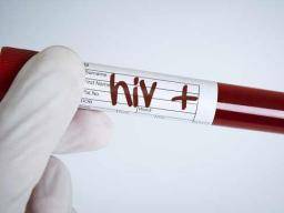 HIV-Risiko durch spezifische vaginale Bakterien beeinflusst