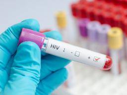 HIV gegen AIDS: Was ist der Unterschied?