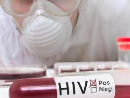 HIV: Was sind die Symptome?
