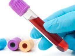 Jak by mohl jeden test krve identifikovat celou historii virové infekce