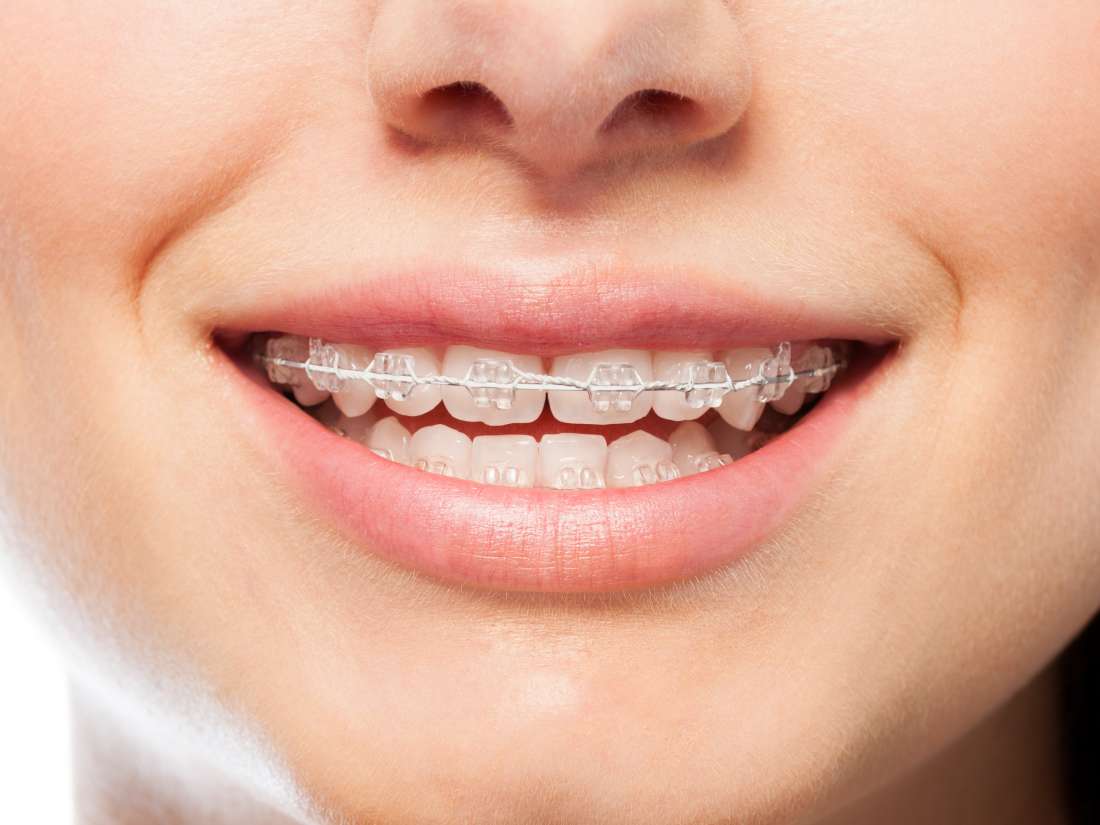 Jak muze ortodontická lécba pomoci?