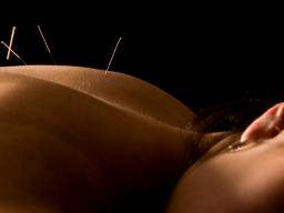 Comment fonctionne l'acupuncture?