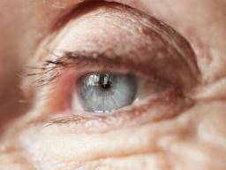 Kaip artritas veikia akis?