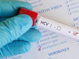 Kaip persodinamas hepatitas C?