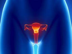 THS lié au risque de cancer de l'ovaire