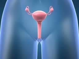 L'hystérectomie, y compris la suppression de l'ovaire, réduit le risque de cancer de l'ovaire - n'augmente pas les autres risques