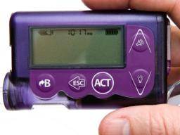 Inzulínové pumpy jsou "úcinnejsí nez injekce" u diabetu 2. typu