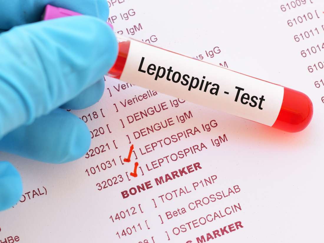 Leptospirose: Was Sie wissen müssen