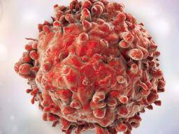 Leucémie: cellules cancéreuses tuées par un médicament contre le diabète