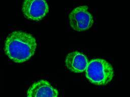 Leukämiezellen können sich gegenseitig töten, Funde untersuchen
