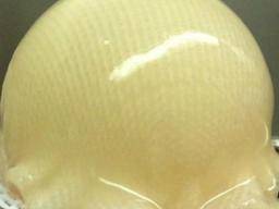 Lebender Knorpel, der mit Stammzellen gezüchtet wird, könnte eine Hüftoperation verhindern