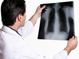 Dolní funkce plic a obstrukce proudení vzduchu zvysují riziko selhání srdce