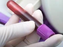 Rakovina plic: Krevní test muze vést k dríve, individuální lécbe