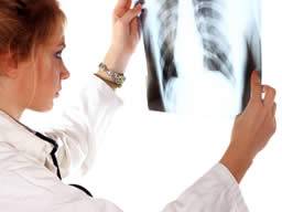Test respiratoire du cancer du poumon plus prometteur