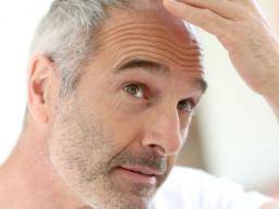 Männliche Haarausfall: Was Sie wissen müssen
