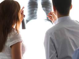 Los pacientes casados ??con cáncer de pulmón tienen una mejor probabilidad de supervivencia