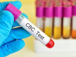 MCH hladiny v krevních testech: Co to znamenají?
