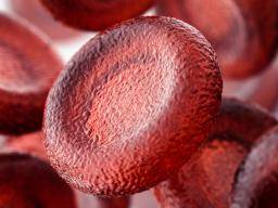 MDS simptomai: Kokie yra isankstines leukemijos pozymiai?
