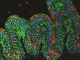 Miniaturmenschlicher Magen, der aus Stammzellen gewachsen ist