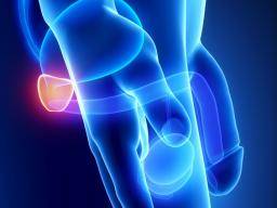Presnejsí diagnózy rakoviny prostaty nabízené senzorovým cipem