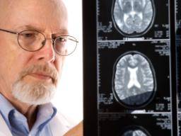 MRI by mohla poskytnout presnou a casnou diagnózu ADHD