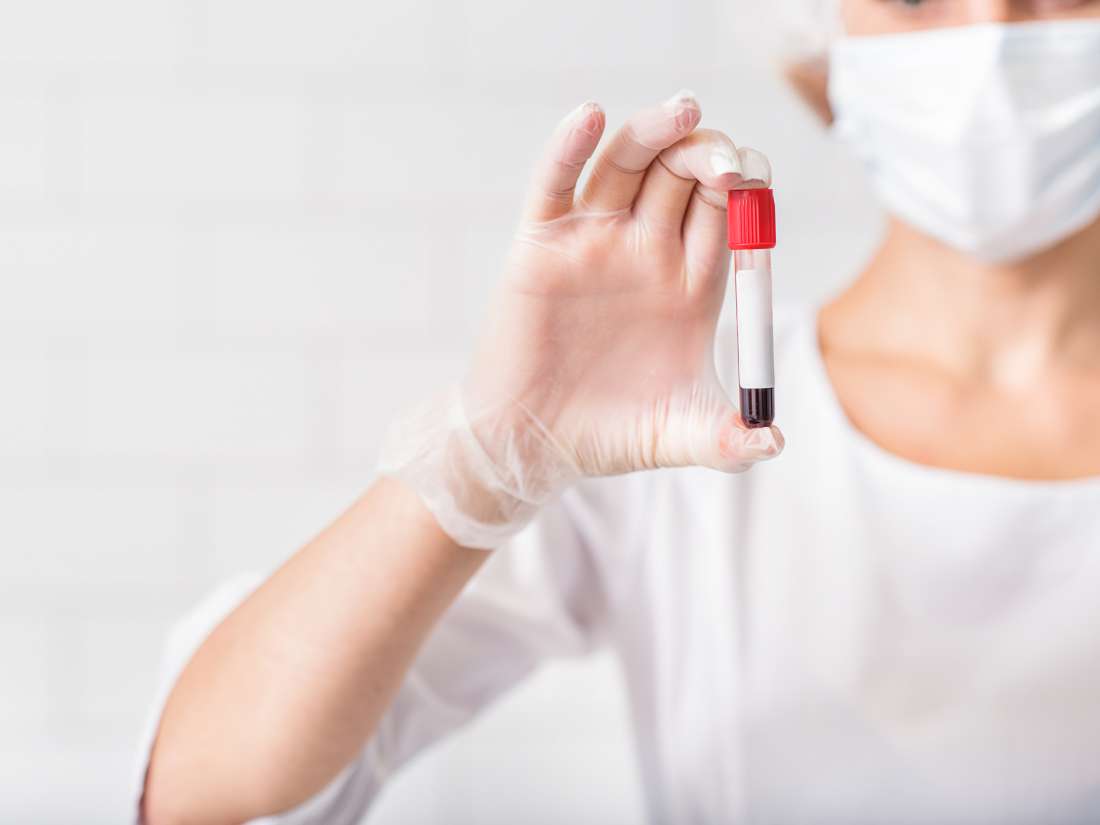 MS: le test sanguin offre un nouveau moyen de surveiller l'activité de la maladie