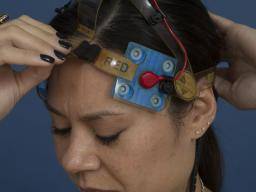 Multiple Sklerose: Neue Technologie verbessert die Kognition