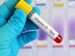 Esclerosis múltiple: la deficiencia de vitamina D puede predecir el inicio