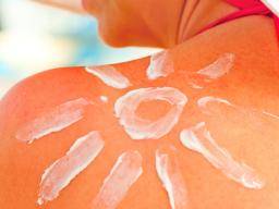 Keletas saules nudegimu kaip paauglys padidina melanomos rizika 80%