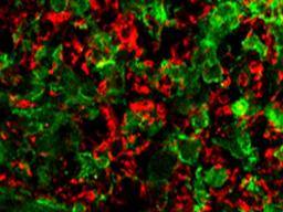 Tvorba myelinu, funkce koncetiny obnovená na modelech mysí MS