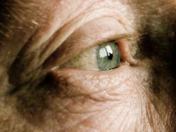 Nano-vaistas sausoms akims suteikia maziau rupesciu