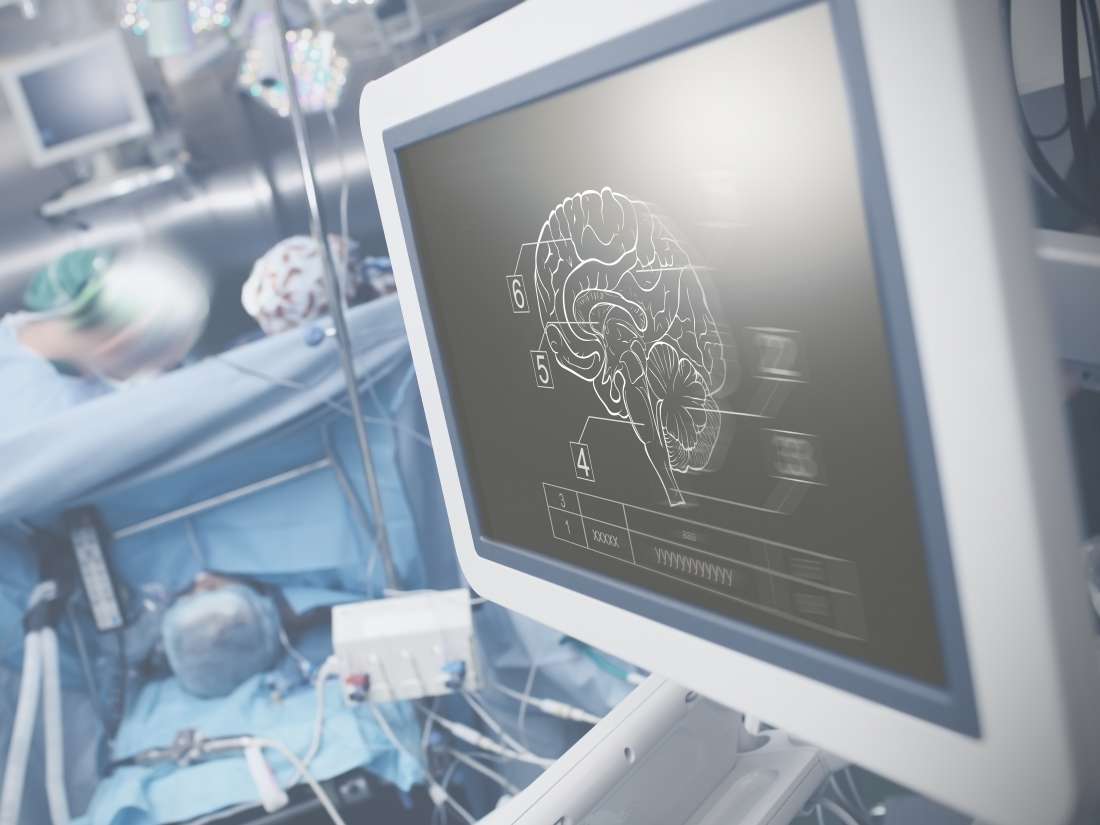 Neurochirurgen vermeiden Gehirnoperationen, führen unnötige Tests durch