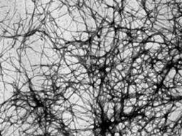 Neue Alzheimer-Behandlungen können sich aus der Modellierung von Hitzeschockproteinen ergeben