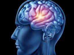 Neue starke Beweise für neurologische Ursachen von Schizophrenie