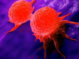 Das nicht-familiäre Brustkrebsrisiko könnte durch genetische Veränderungen vorhergesagt werden