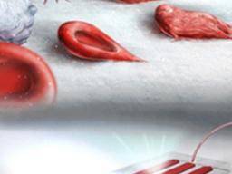 Nové zarízení merí tuhost a lepivost cervených krvinek