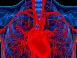 NSAIDS verbunden mit Blutungsrisiko bei Herzinfarktpatienten