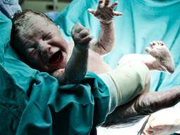 Geburtshilfe für Schwangerschaften mit geringem Risiko verbessert nicht die Ergebnisse der Geburt, Studie findet