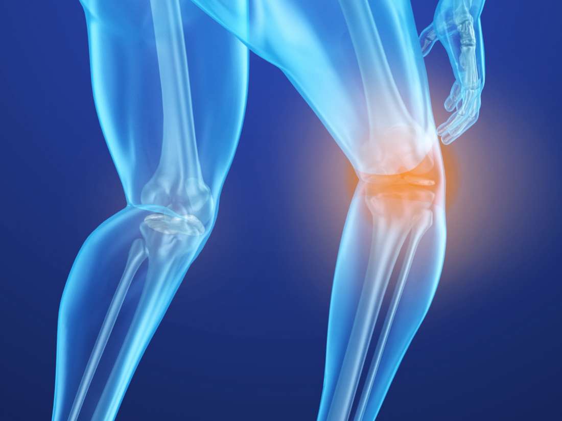 Osteoporóza: Pokyny pro lécbu aktualizací ACP pro prevenci zlomenin kostí