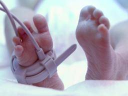 Résultats chez les nouveau-nés extrêmement prématurés améliorés au cours des 20 dernières années