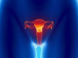 Le risque de cancer de l'ovaire dépend de facteurs de reproduction