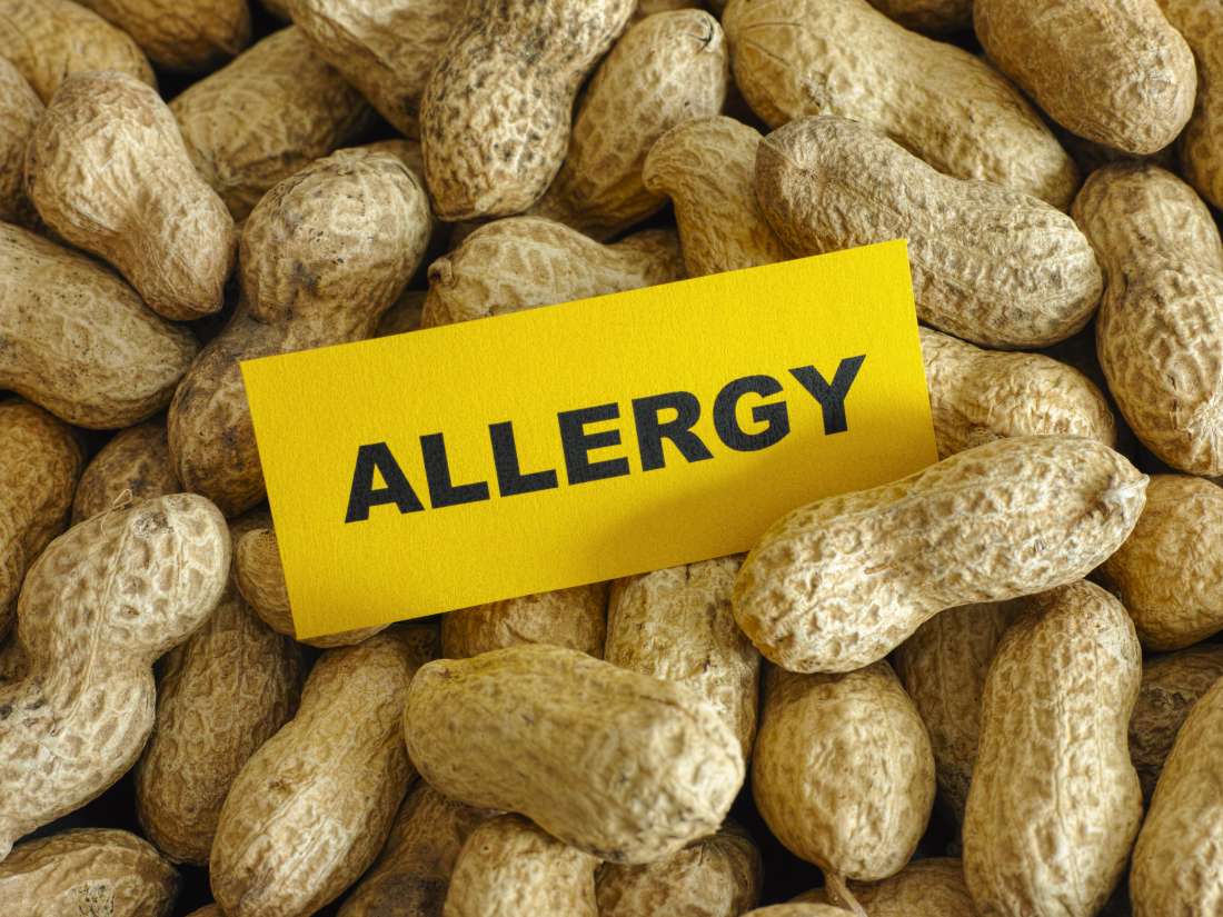 Allergie à l'arachide: Six gènes responsables de réactions allergiques