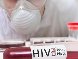 Lidé, kterí produkují silné protilátky proti HIV, mají specifický imunologický profil