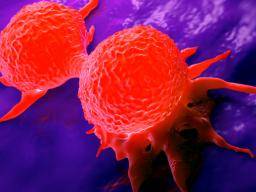 Personnaliser le traitement du cancer avec l'aide de «tumeurs virtuelles»