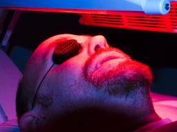 Terapia fotodinámica para el acné: costos y recuperación