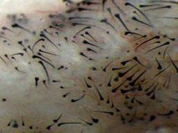 Cellules souches pluripotentes utilisées pour générer la croissance des cheveux