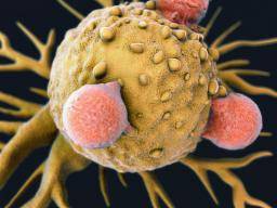 Le poliovirus tue les cellules cancéreuses, arrête la repousse de la tumeur