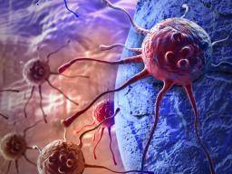 Predecir la propagación del tumor clasificando las células cancerosas que viajan