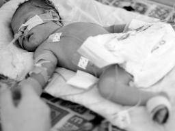 Predcasné porodení bylo identifikováno jako hlavní prícina smrti u malých detí